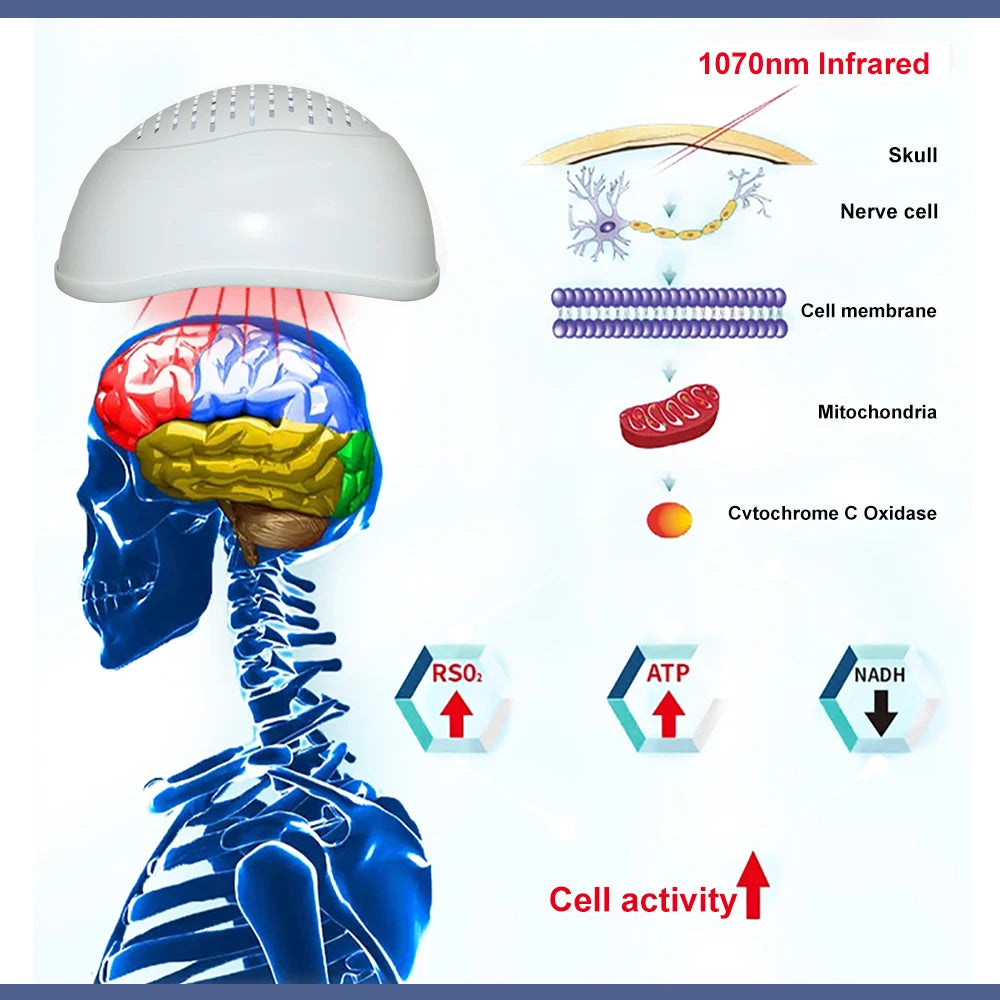ZJKC Infrared Light Helmet 1070nm Dementia Therapy Device for Stroke Victims Enhance Brain Activity and Cognition