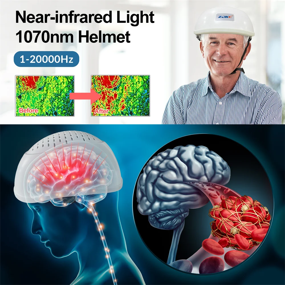 ZJKC Infrared Light Helmet 1070nm Dementia Therapy Device for Stroke Victims Enhance Brain Activity and Cognition