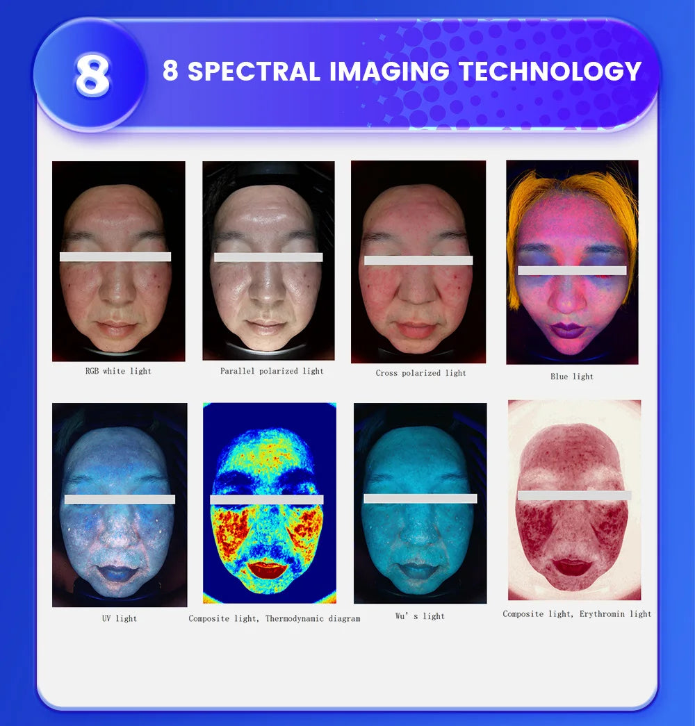 Emszero AISIA Q1 3D AI Facial Skin Analyzer Diagnosis