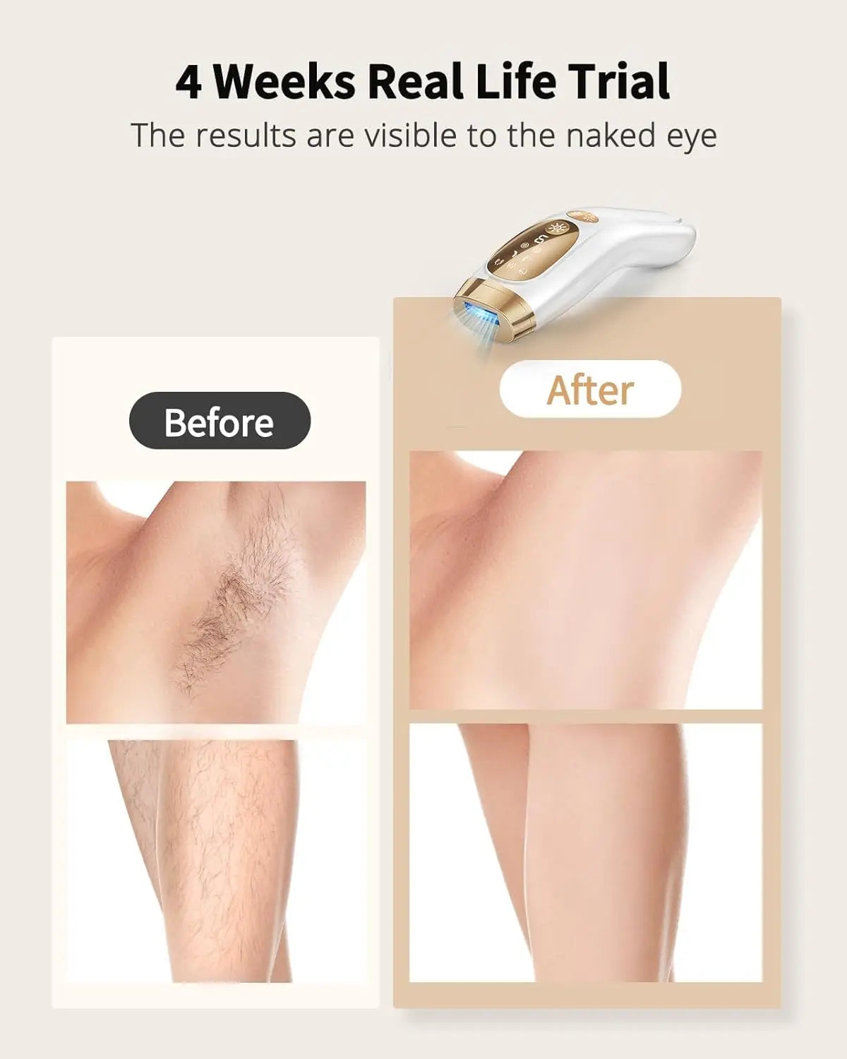 IPL Hair Removal Unlimited Flashes 9 Gears Laser Ice Cooling Painless Electric Depilator for Men and Women Body Bikinis Intimate